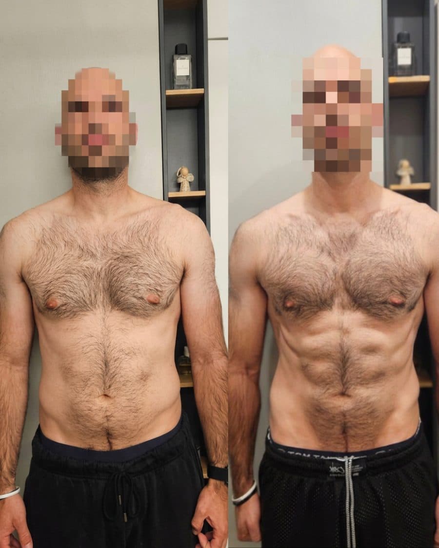 Matty, before and after